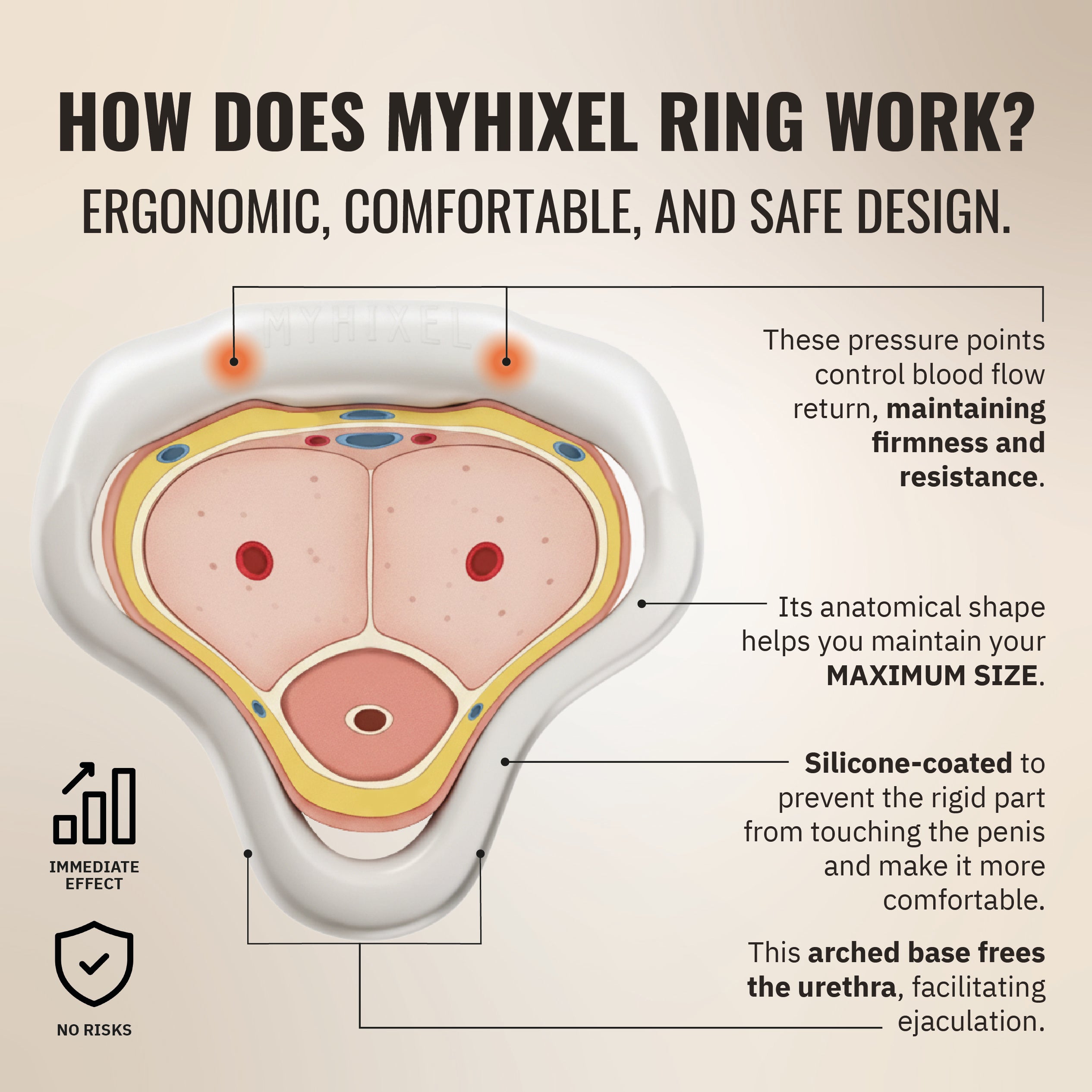 MYHIXEL Ring
