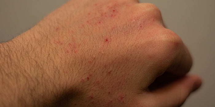 Graphic illustration depicting science-backed research on rare sex allergies, including semen and latex sensitivities.